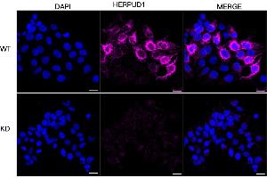 Immunocytochemical staining of HeLa cells using HERPUD1 antibody (ABIN7798998), 1:1,000), Top panel: wild-type (WT), Bottom panal: HERPUD1 shRNA knockdown (KD).