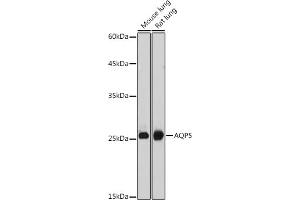 Western blot analysis of extracts of various cell lines, using  antibody (ABIN6133586, ABIN6137050, ABIN6137052 and ABIN6225252) at 1:1000 dilution. (Aquaporin 5 Antikörper  (AA 150-250))