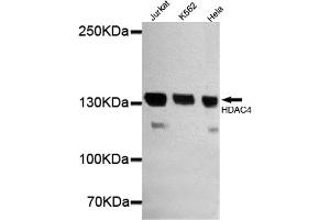 Western blot detection of HDAC4 in Jurkat,Hela and K562 cell lysates using HDAC4 mouse mAb (1:1000 diluted). (HDAC4 Antikörper  (N-Term))