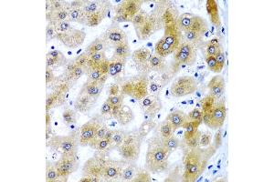 Immunohistochemistry of paraffin-embedded human liver damage using SECISBP2 antibody (ABIN6128699, ABIN6147497, ABIN6147498 and ABIN6222461) at dilution of 1:200 (40x lens). (SECISBP2 Antikörper  (AA 585-854))