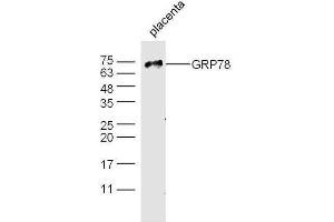 Mouse placenta probed with Rabbit Anti-GRP78 Polyclonal Antibody, Unconjugated  at 1:500 for 90 min at 37˚C. (GRP78 Antikörper  (AA 251-360))