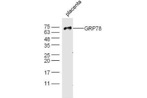 Mouse placenta probed with Rabbit Anti-GRP78 Polyclonal Antibody, Unconjugated  at 1:500 for 90 min at 37˚C.