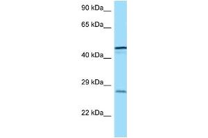 WB Suggested Anti-TREM1 Antibody Titration: 1. (TREM1 Antikörper  (C-Term))