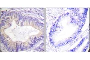 Immunohistochemistry (IHC) image for anti-Cas-Br-M (Murine) Ecotropic Retroviral Transforming Sequence (CBL) (AA 740-789) antibody (ABIN2888650) (CBL Antikörper  (AA 740-789))