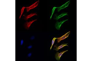 ABIN6261648 and ABIN6276771 staining Hela cells by IF/ICC.