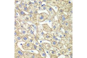 Immunohistochemistry (Paraffin-embedded Sections) (IHC (p)) image for anti-Glutamate Dehydrogenase 2 (GLUD2) (AA 319-558) antibody (ABIN6141159)