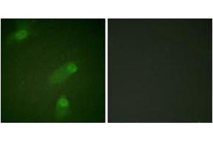Immunofluorescence analysis of HeLa cells, using NF-kappaB p105/p50 (Ab-927) Antibody. (NFKB1 Antikörper  (AA 896-945))