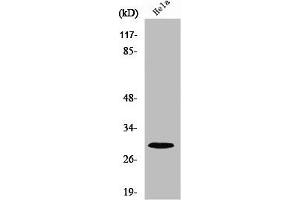Western Blot analysis of COLO205 cells using Ribosomal Protein S4X Polyclonal Antibody (RPS4X Antikörper  (Internal Region))
