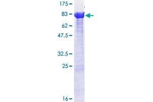 Image no. 1 for Protein Phosphatase 2, Regulatory Subunit A, beta (PPP2R1B) (AA 1-601) protein (GST tag) (ABIN1316016) (PPP2R1B Protein (AA 1-601) (GST tag))