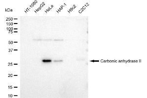 Western blotting analysis using Carbonic anhydrase II antibody (ABIN7797868). (Rekombinanter CA2 Antikörper)