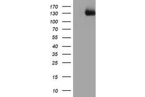Western Blotting (WB) image for anti-PTK7 Protein tyrosine Kinase 7 (PTK7) antibody (ABIN1497127)