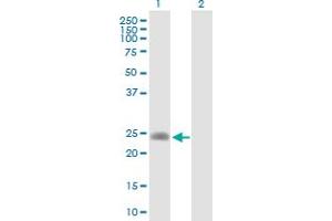 Western Blot analysis of LDHAL6A expression in transfected 293T cell line by LDHAL6A MaxPab polyclonal antibody.