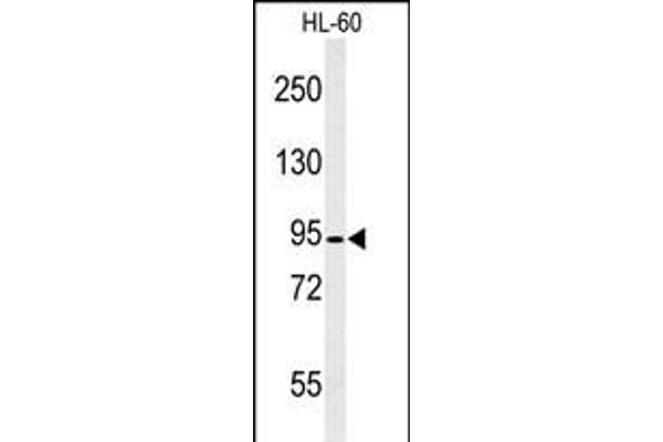 Calpain 3 Antikörper  (C-Term)