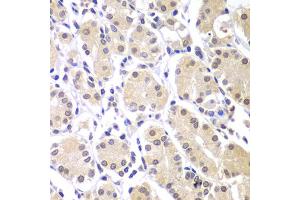 Immunohistochemistry of paraffin-embedded human gastric using CHEK1 antibody. (CHEK1 Antikörper)