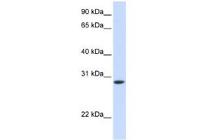 WB Suggested Anti-TNNT3 Antibody Titration:  0. (TNNT3 Antikörper  (C-Term))