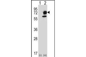 Western blot analysis of ITPKB (arrow) using rabbit polyclonal ITPKB Antibody (R38) (ABIN652430 and ABIN2842237).