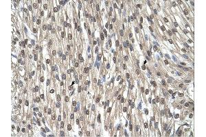 SHMT2 antibody was used for immunohistochemistry at a concentration of 4-8 ug/ml. (SHMT2 Antikörper)