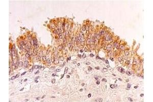 Immunohistochemistry (IHC) image for anti-Four and A Half LIM Domains 2 (FHL2) antibody (ABIN487469)
