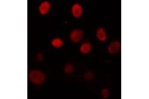 ABIN6274325 staining Hela cells by IF/ICC. (TEF Antikörper  (Internal Region))