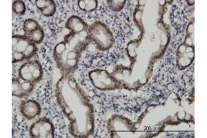 Image no. 2 for anti-Checkpoint with Forkhead and Ring Finger Domains (CHFR) (AA 1-653) antibody (ABIN599268) (CHFR Antikörper  (AA 1-653))