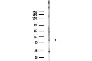 anti-Apolipoprotein H (Beta-2-Glycoprotein I) (APOH) (C-Term) antibody