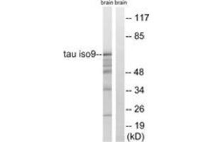 Western blot analysis of extracts from rat brain, using Tau (Ab-717/400) Antibody. (tau Antikörper  (AA 366-415))