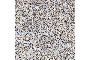 IHC analysis of SNRNP40 using anti-SNRNP40 antibody (ABIN7601719). (SNRNP40 Antikörper  (AA 43-357))