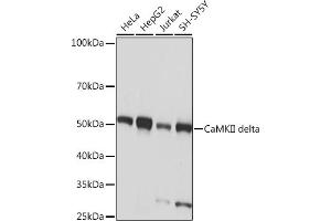 Western blot analysis of extracts of various cell lines, using CaMKII delta Rabbit mAb (ABIN7266019) at 1:1000 dilution. (CAMK2D Antikörper)