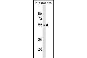 Western blot analysis in human placenta tissue lysates (35ug/lane). (TARBP2 Antikörper  (N-Term))