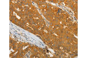 Immunohistochemistry (IHC) image for anti-USO1 Homolog, Vesicle Docking Protein (USO1) antibody (ABIN1875291) (USO1 Antikörper)