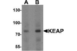 Western blot analysis of KEAP1 in human lung tissue lysate with KEAP1 Antibody  at (A) 1 and (B) 2 μg/ml. (KEAP1 Antikörper  (C-Term))