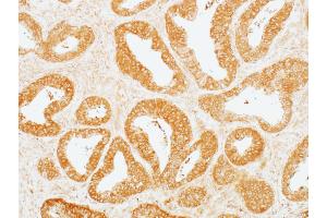 Immunohistochemistry (IHC) image for anti-Mitogen-Activated Protein Kinase Kinase 2 (MAP2K2) (AA 1-50) antibody (ABIN7454013) (Rekombinanter MEK2 Antikörper  (AA 1-50))