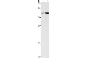 Western Blotting (WB) image for anti-Guanine Nucleotide Binding Protein (G Protein), beta 5 (GNB5) antibody (ABIN2428148) (GNB5 Antikörper)