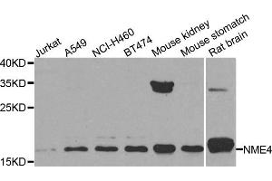Western blot analysis of extracts of various cell lines, using NME4 antibody. (NME4 Antikörper)