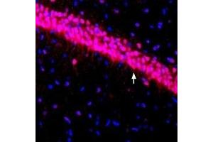 Immunohistochemistry (IHC) image for anti-Potassium Voltage-Gated Channel, Shal-Related Subfamily, Member 3 (KCND3) (AA 451-468), (Intracellular) antibody (ABIN7043536)