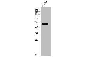 Western Blot analysis of JK cells using AR-α1A Polyclonal Antibody (alpha 1 Adrenergic Receptor Antikörper  (Internal Region))