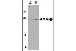 Western blot analysis of MANF in mouse brain tissue lysate with this product at (A) 1 and (B) 2 μg/ml. (MANF Antikörper  (C-Term))