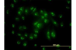 Immunofluorescence (IF) image for anti-Proteasome (Prosome, Macropain) 26S Subunit, ATPase, 6 (PSMC6) (AA 290-389) antibody (ABIN519392)