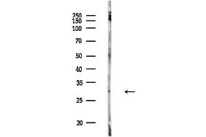 anti-Charged Multivesicular Body Protein 1A (CHMP1A) (C-Term) antibody