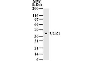 Western blot analysis of 10 ug of total cell lysate from A-375 cells with CCR1 polyclonal antibody  at 2 ug/mL dilution. (CCR1 Antikörper  (AA 339-350))