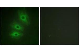Immunofluorescence analysis of HeLa cells, using ADCY5/6 Antibody. (ADCY5/6 Antikörper  (AA 931-980))