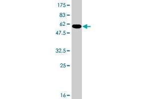 Western Blot detection against Immunogen (49. (RAB11A Antikörper  (AA 1-216))