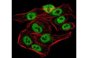 Immunofluorescence (IF) image for anti-Lysine (K)-Specific Demethylase 1B (KDM1B) (AA 6-129) antibody (ABIN5542688)