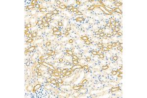 Immunohistochemistry analysis of paraffin-embedded mouse kidney using GBA (ABIN7074062) at dilution of 1: 2000 (GBA Antikörper)