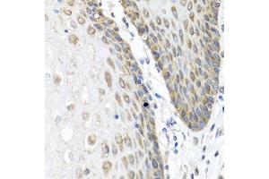 Immunohistochemistry of paraffin-embedded human esophagus using  antibody (ABIN6127432, ABIN6136873, ABIN6136875 and ABIN6223859) at dilution of 1:100 (40x lens). (Angiopoietin 1 Antikörper  (AA 260-400))