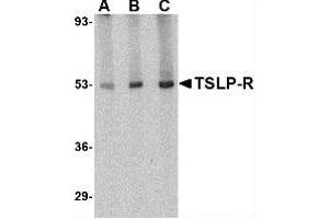 Image no. 1 for anti-Cytokine Receptor-Like Factor 2 (CRLF2) (Center) antibody (ABIN302657) (CRLF2 Antikörper  (Center))