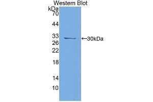 Western blot analysis of the recombinant protein. (PTPRJ Antikörper  (AA 1033-1277))