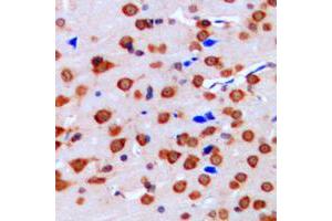 Immunohistochemical analysis of ERK1/2 staining in human brain formalin fixed paraffin embedded tissue section.