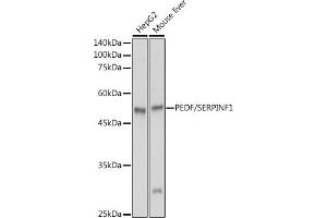 Western Blotting (WB) image for anti-serpin Peptidase Inhibitor, Clade F (Alpha-2 Antiplasmin, Pigment Epithelium Derived Factor), Member 1 (SERPINF1) (AA 1-200) antibody (ABIN3022373)
