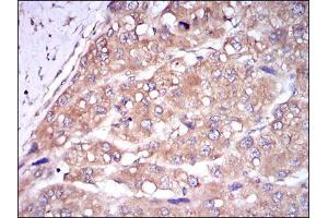 Immunohistochemistry (IHC) image for anti-Caspase 8 (CASP8) antibody (ABIN969003)
